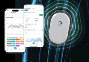 SIBIONICS GS1 CGM Sistema de monitoreo continuo de glucosa
